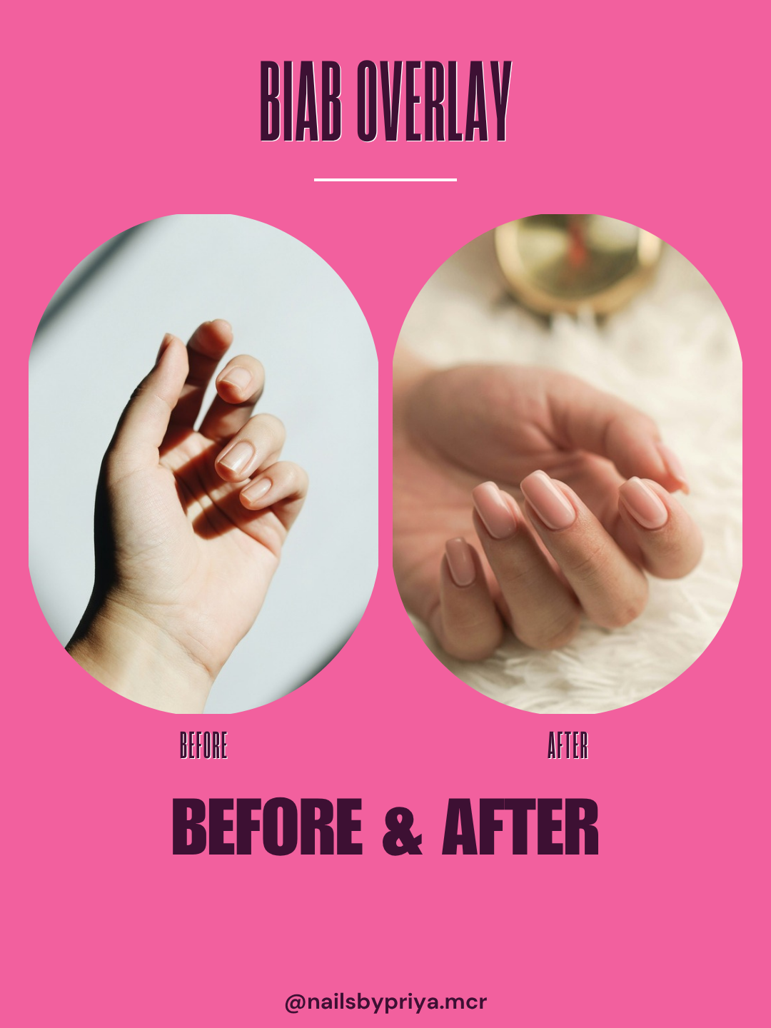 BIAB overlay before and after post example